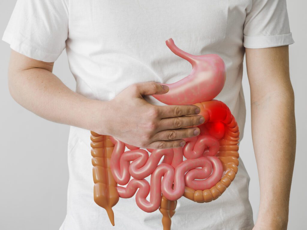 Crohn’s Disease: A Comprehensive Guide to Symptoms, Causes and Management